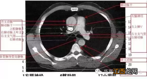 心脏在人体什么位置 心脏示意图