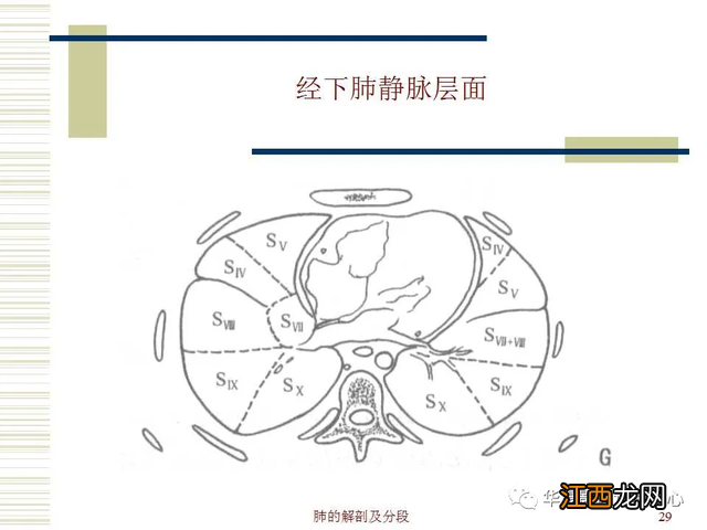 心脏在人体什么位置 心脏示意图