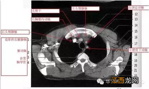 心脏在人体什么位置 心脏示意图