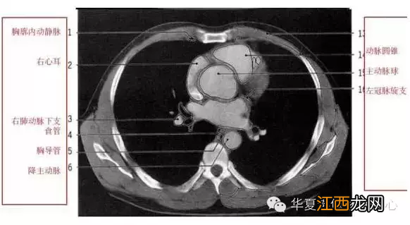 心脏在人体什么位置 心脏示意图