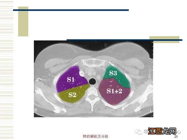 心脏在人体什么位置 心脏示意图