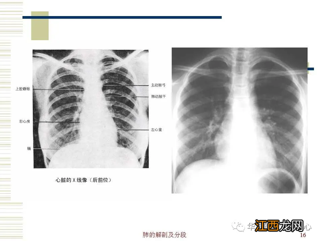 心脏在人体什么位置 心脏示意图