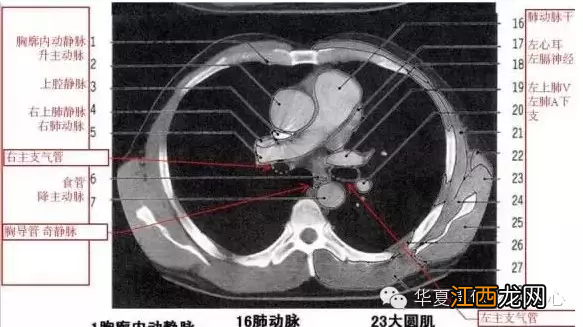 心脏在人体什么位置 心脏示意图