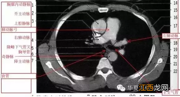 心脏在人体什么位置 心脏示意图