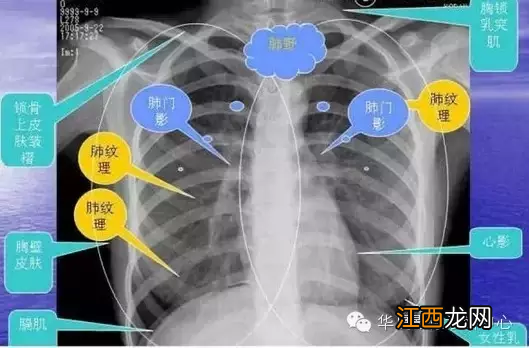 心脏在人体什么位置 心脏示意图