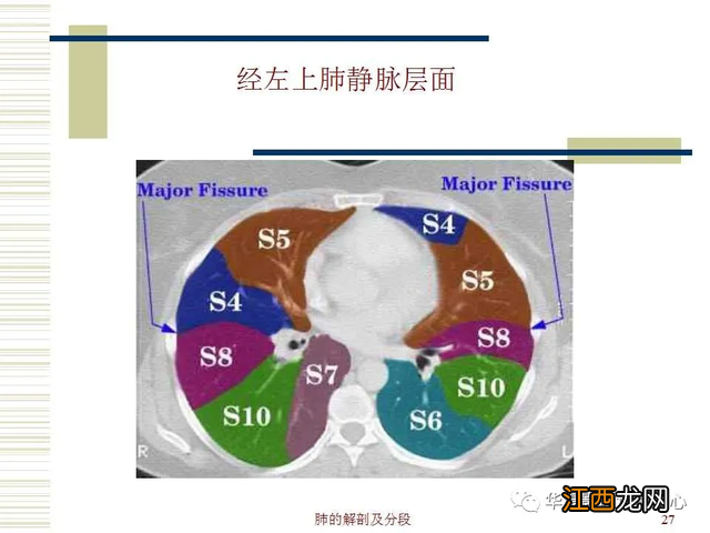 心脏在人体什么位置 心脏示意图