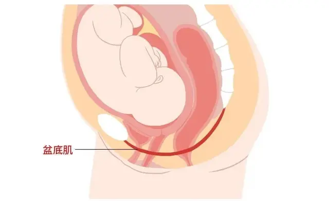 医院产后盆底肌修复费用 剖腹产需要做盆底肌修复吗