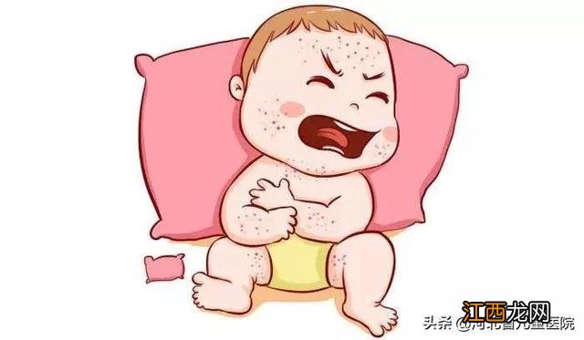 孩子出疹子怎么治疗 孩子出疹子怎么治