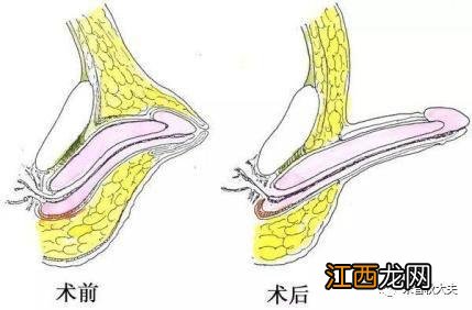 男人鸡鸡照片