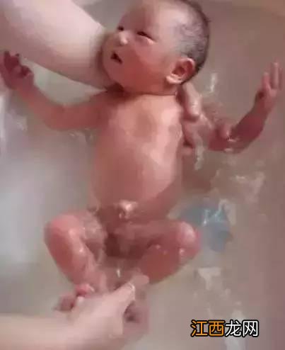 脐茸图片 自愈 脐茸图片