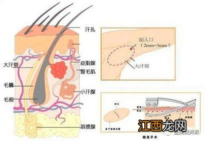 永久去狐臭小妙招不用药 永久去狐臭小妙招