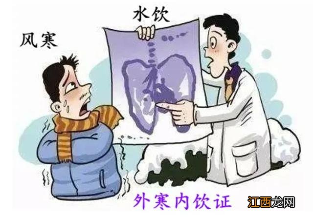 小青龙颗粒的功效与作用流清鼻涕头疼 小青龙颗粒的功效