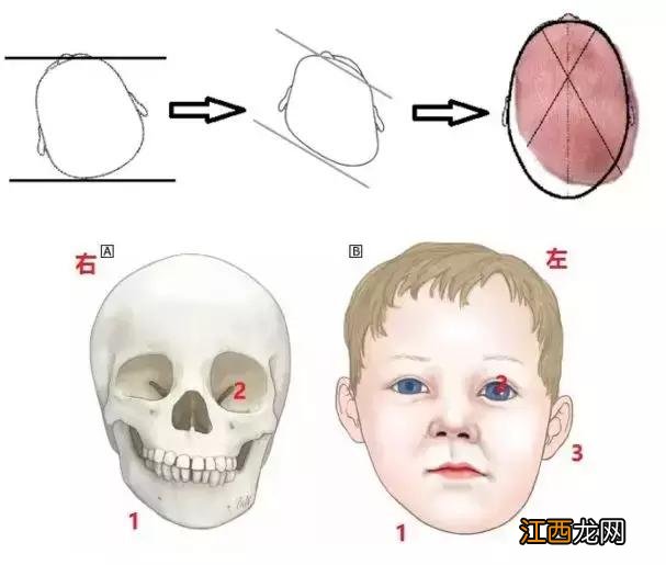 怎么快速纠正宝宝偏头 纠正宝宝偏头妙招