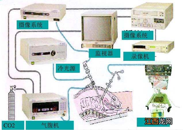 腹腔镜检查是怎么做的疼吗 腹腔镜检查是怎么做的