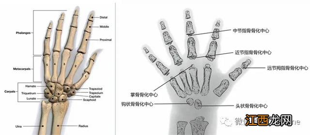 骨龄测身高准确率多少 骨龄测身高