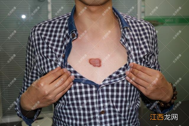 北京疤康医院是正规的吗 北京疤康医院