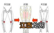 5种走路姿势会让你变成O型腿