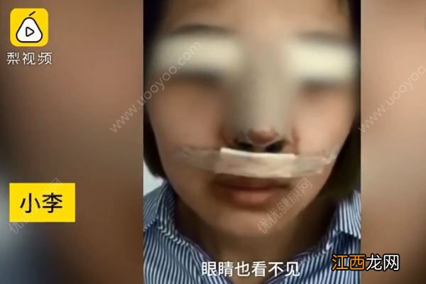 想当网络主播贷款3万整容，结果遭“毁容”