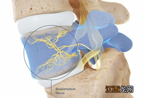 称为椎间盘源性腰痛 腰痛就是腰椎病吗看专家怎么说