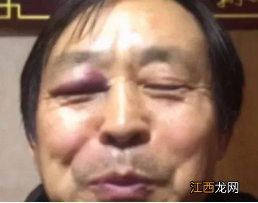 你不讲武德是什么梗