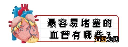 血管最容易发生堵塞的3个地方 血管堵塞最快的方法图解