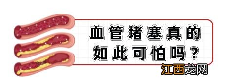 血管最容易发生堵塞的3个地方 血管堵塞最快的方法图解