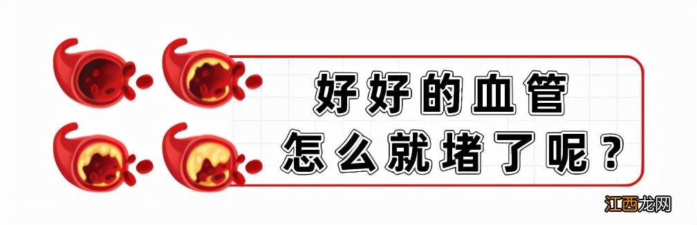 血管最容易发生堵塞的3个地方 血管堵塞最快的方法图解