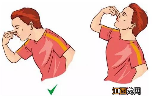 流鼻血时 有时塞个棉花球反而会休克