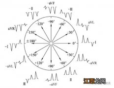 心电轴右偏是什么意思