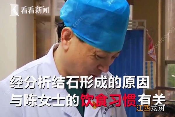 爱吃油炸长468颗结石,油炸食品的危害有哪些?