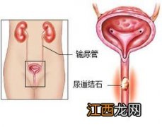 狗的尿道结石长什么样