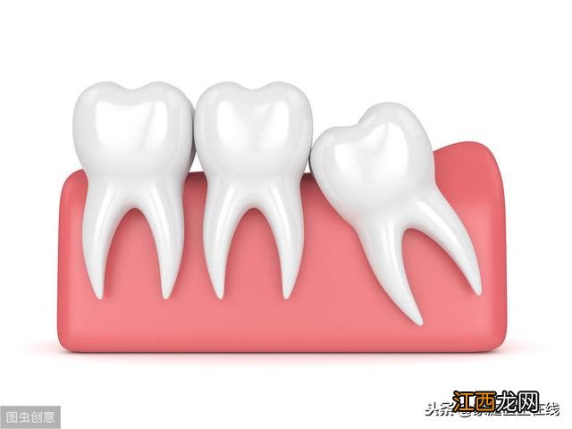 拔完智齿后脸会不会变小 智齿拔了一段时间后脸会变小吗