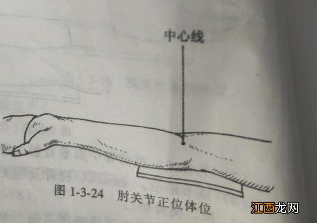 学习X线读片指南骨 夏科氏关节病x线表现