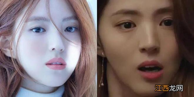 明明都追求牙齿整齐，为什么牙齐不等于动态好看？