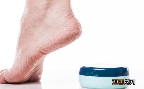 冬天脚后跟干裂怎么办?冬天脚后跟干裂如何处理?