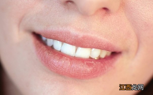 秋季嘴唇干裂还流血?吃这些食物让你双唇水润!