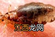 甲肝会传染吗 甲肝病毒存在于哪里