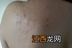 如何让头发更加的有光泽呢？怎样使头发有光泽？