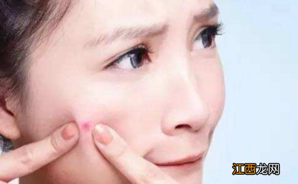 夏季长痘在饮食上要注意哪些？夏季长痘痘吃什么好？