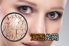 秋季如何做好唇部保养?秋季护唇的好方法有哪些?