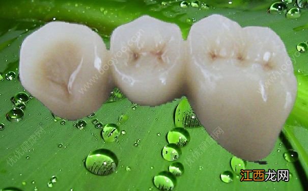 种植牙和烤瓷牙有什么不同？种植牙和烤瓷牙哪个好？