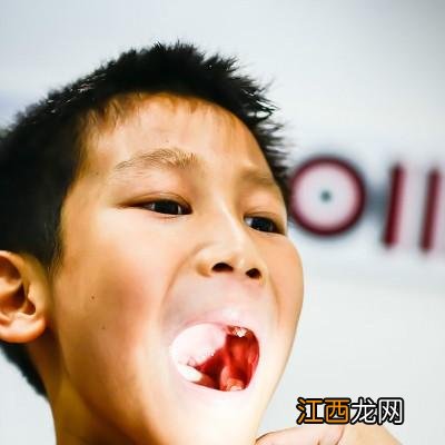 嘴巴里面烂了怎么办