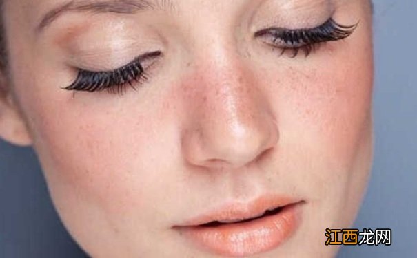 涂了护肤品脸刺痛红？涂护肤品脸刺痛红怎么办？