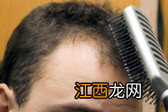 常见的润肠水果有哪些？吃什么水果能润肠通便？