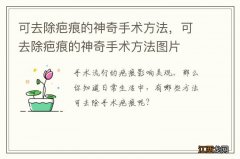 可去除疤痕的神奇手术方法，可去除疤痕的神奇手术方法图片