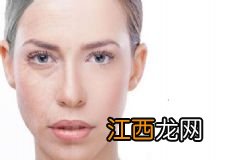 用醋洗脸可以祛斑吗?用醋洗脸祛斑该注意什么?