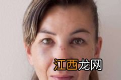 鲜果美容的方法有哪些？鲜果美容怎样做？