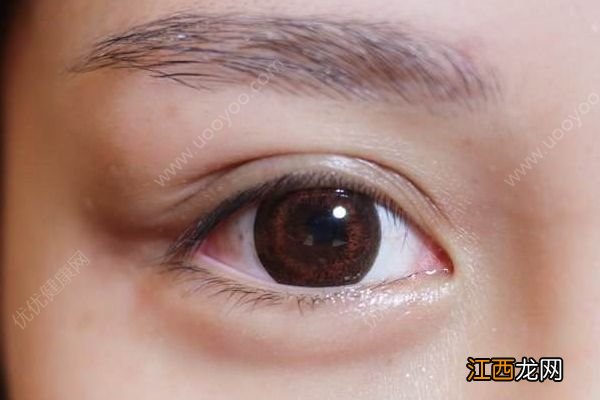 长脂肪粒和眼霜有关系吗？对眼霜的误解很深很深