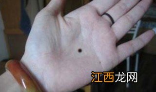 手掌有痣代表什么 手掌有痣是什么意思