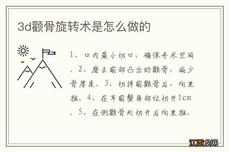 3d颧骨旋转术是怎么做的